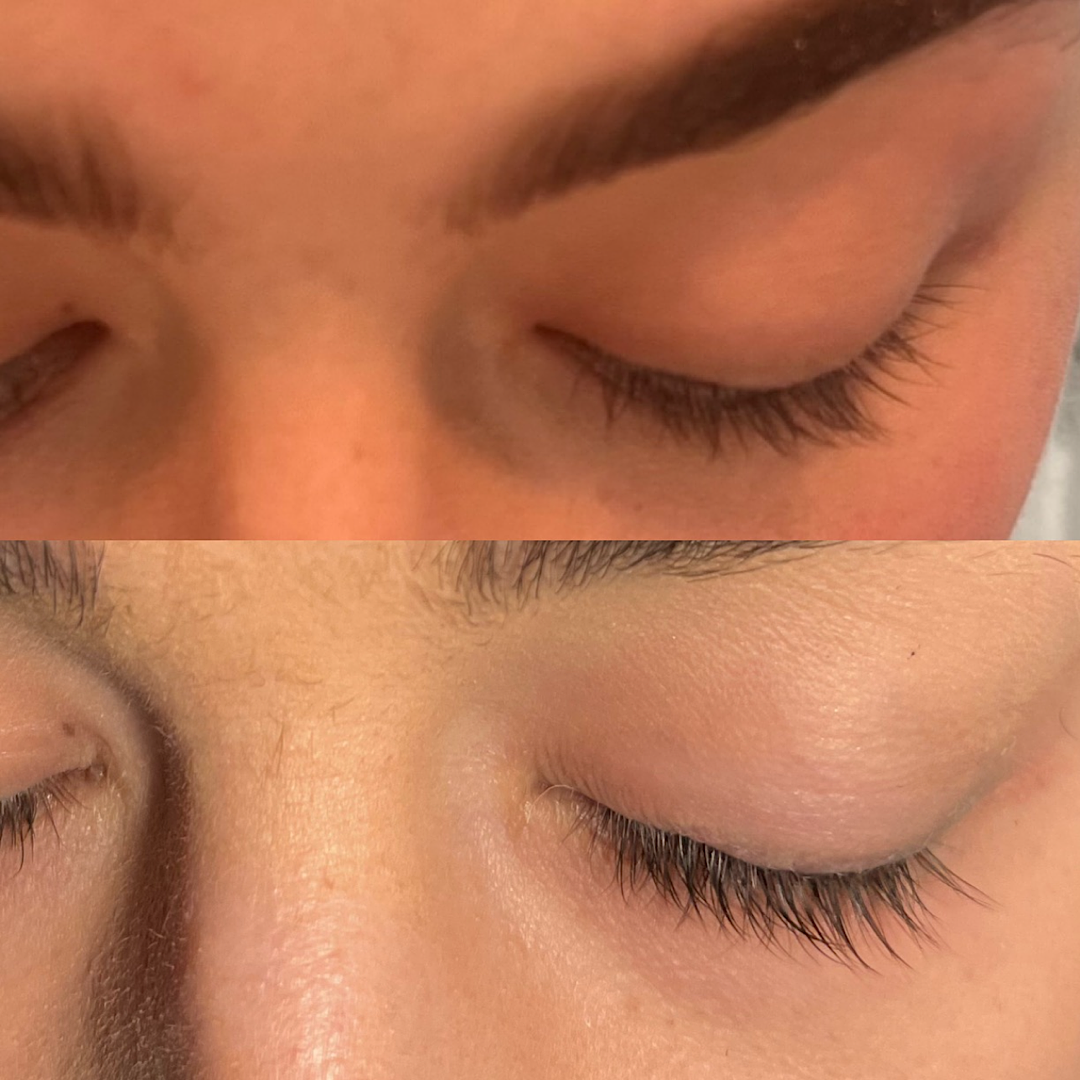 Eyelash Serum